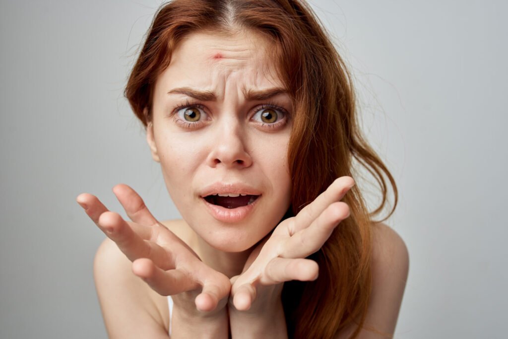 Stress and anxiety can trigger acne